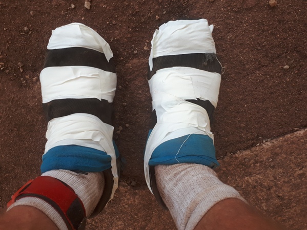 Next attempt - lots of tape to hold the socks in place made it impossible to take my shoes again until the race finished