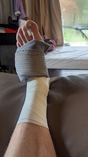 My injured foot